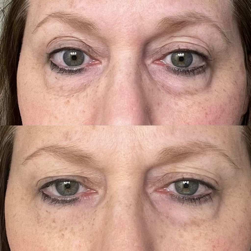 Instant Eye Tightener Easy Wear Formula With Brush Free!